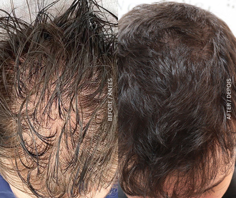 Hair Treatments treatment at AD Lisbon clinic